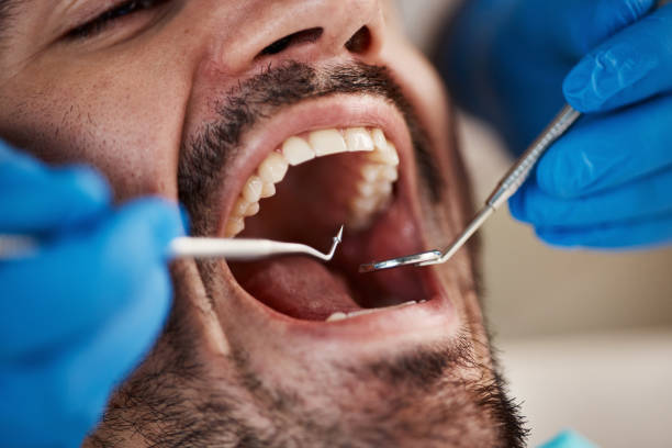 Best Dental Abscess Treatment in Owasso, OK